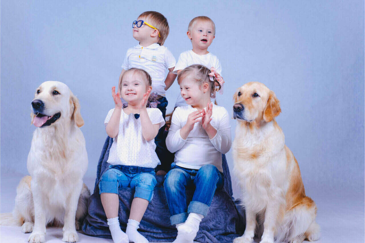 Why Do People With Down Syndrome Look The Same?