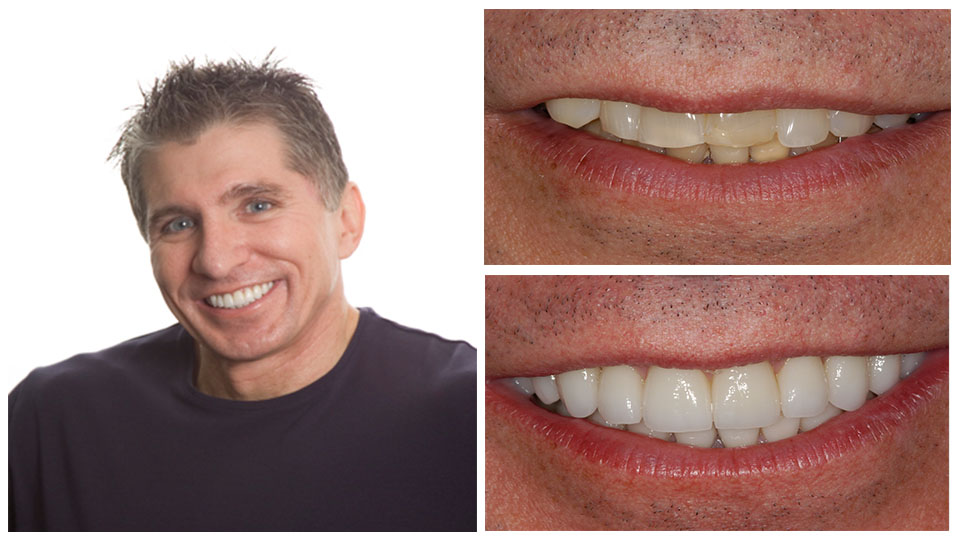 Grand Rapids Cosmetic Dentist Smile Gallery 49525