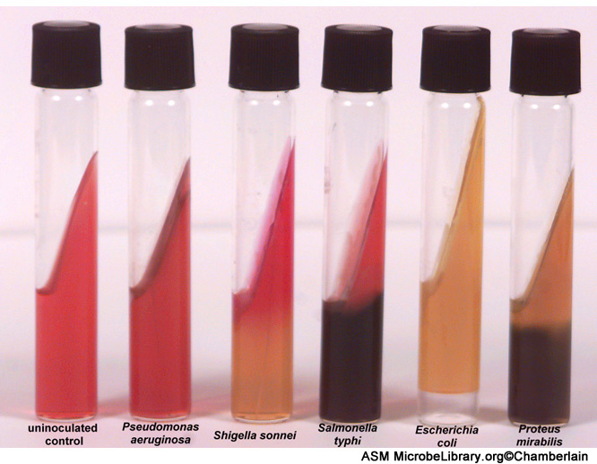 Enterobacteriaceae, Vibrio, Campylobacter and Helicobacter