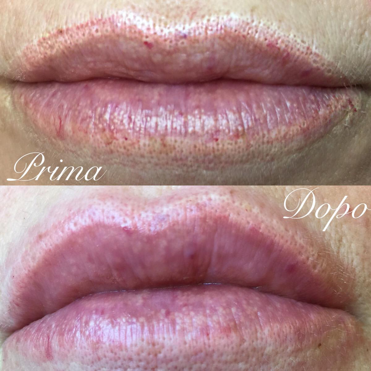 Rimozione Tatuaggi | Microblading & Diamonds 1200_x_1200_jpg