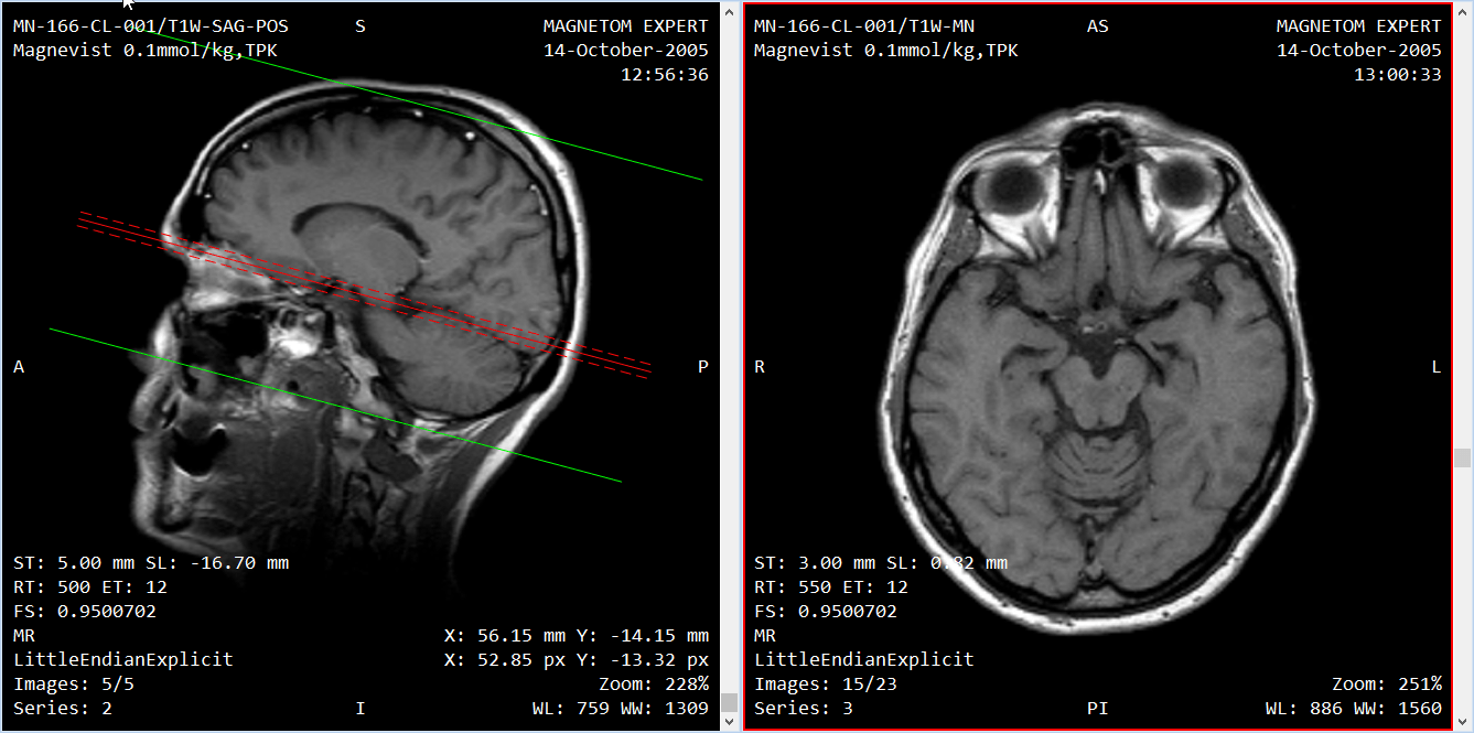 Crossreference lines