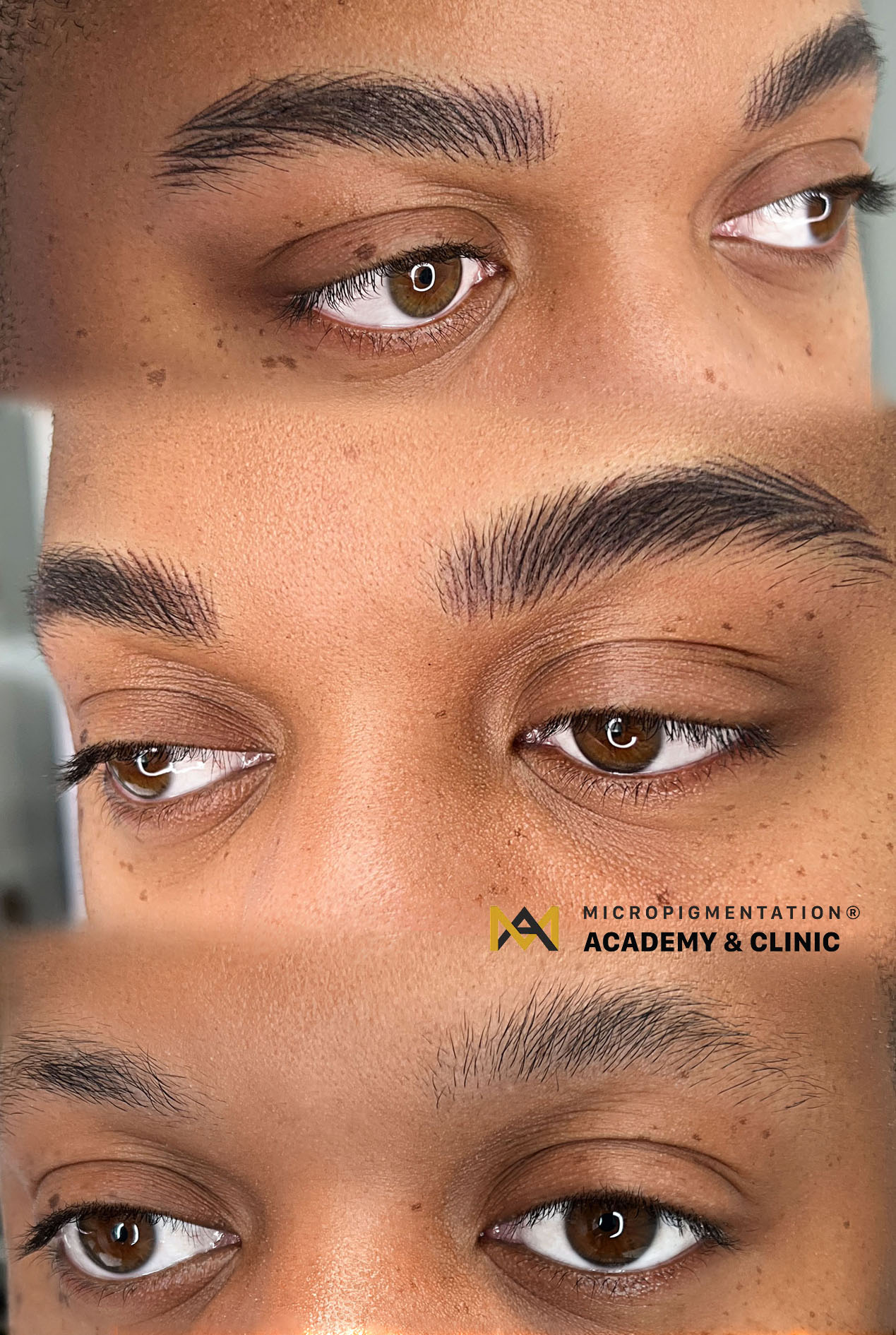 What Is Microblading Eyebrows