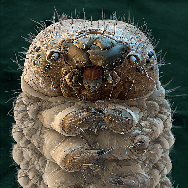 MicroscopyUK microscopy and microscpoes for nonprohessionals