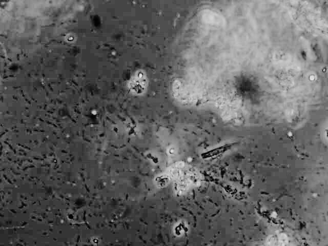 Microscope Picture Of Water Molecule Micropedia