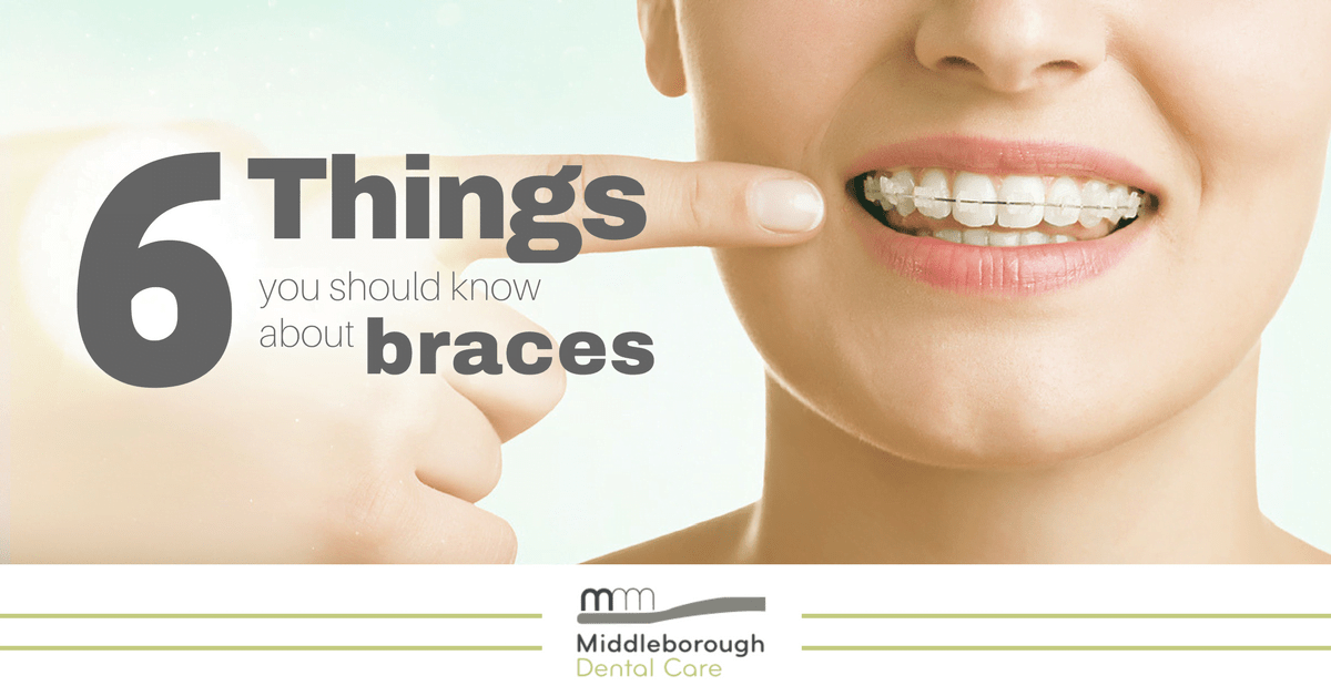 6 things you should know about braces Middleborough Dental Care