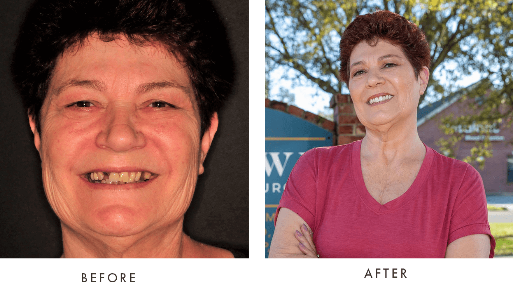 Before & After Photos Midtown Oral & Facial Surgery Hattiesburg, MS