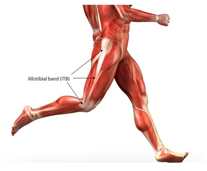 Iliotibial (IT) Band Syndrome MikeBuss
