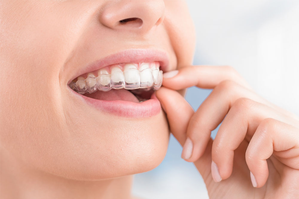 Start Your Child’s Smile Right with Invisalign First Ft Collins