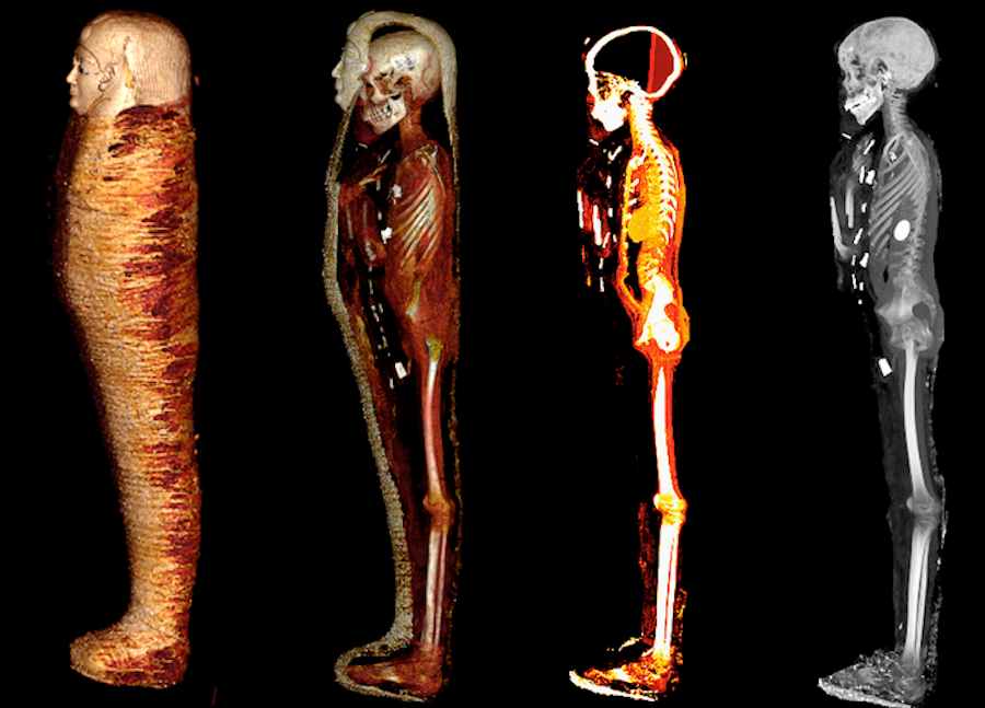 Mummified golden boy comes ‘back to life’ in Egypt