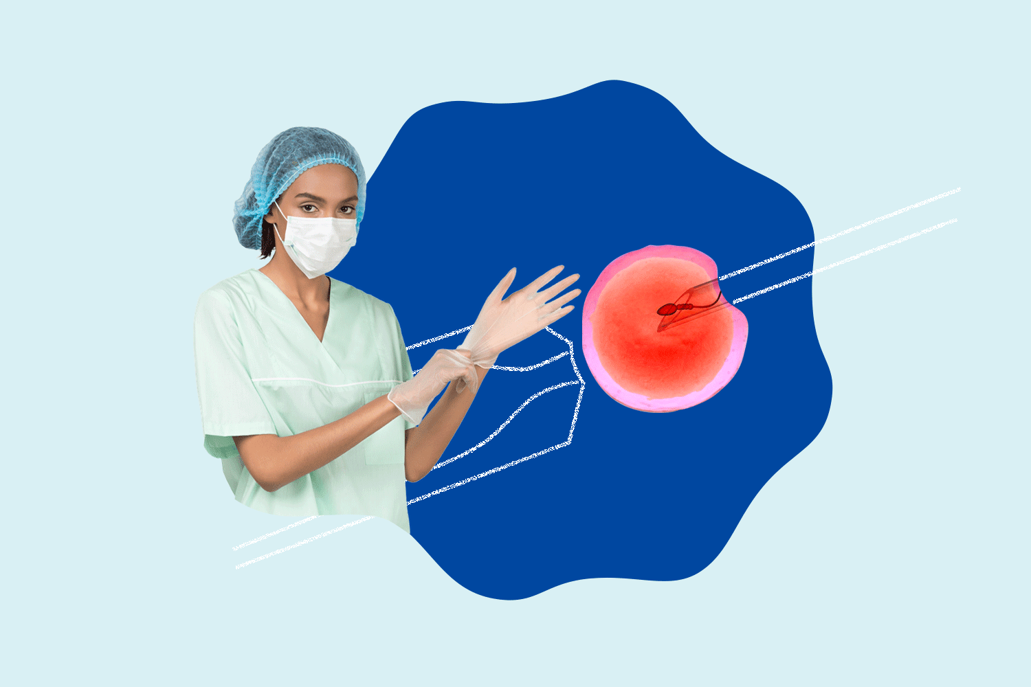 What is IVF and IUI Understanding the Difference Mira Fertility Tracker