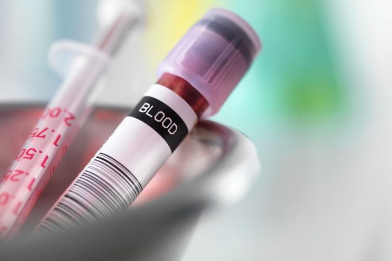Early blood test may help to tackle lung cancer Dr. Miriam Stoppard