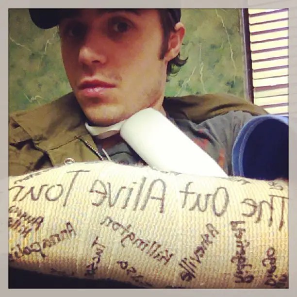 American Idol Kris Allen Shows Off His Cast (PHOTO)