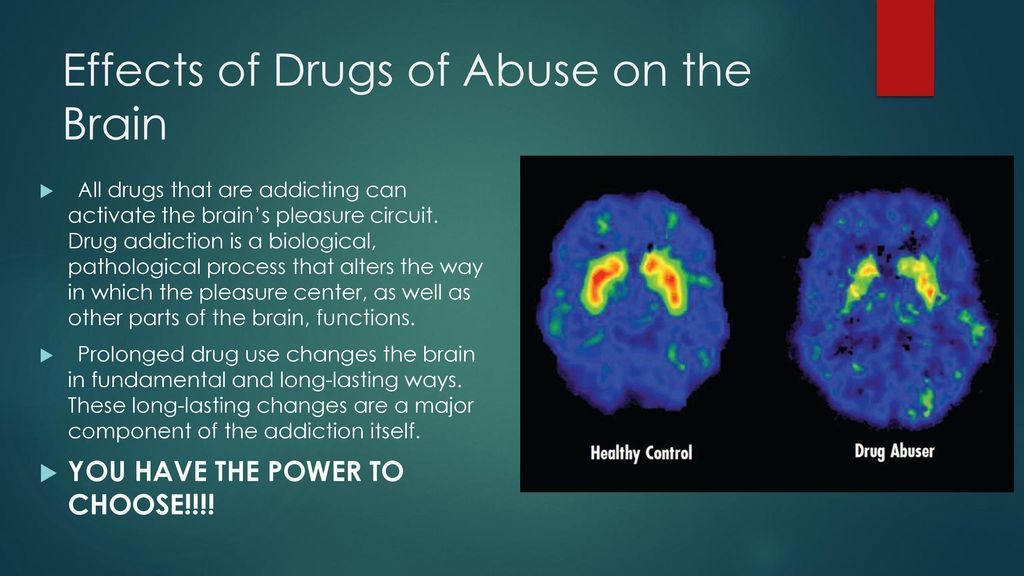 Effects+of+Drugs+of+Abuse+on+the+Brain Montgomery Municipal Cable