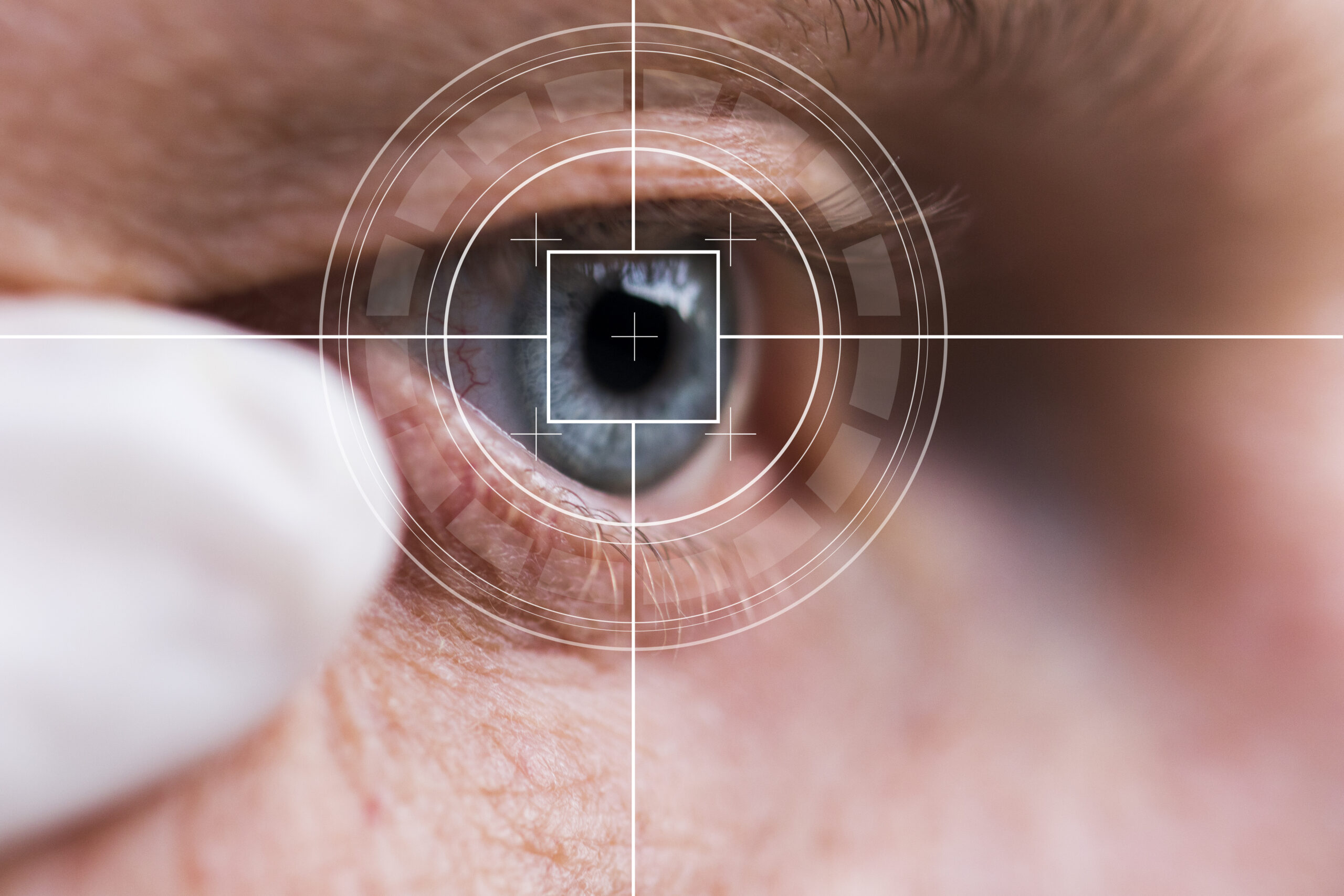 Cataract Surgery and Uveitis MM Eye Tech