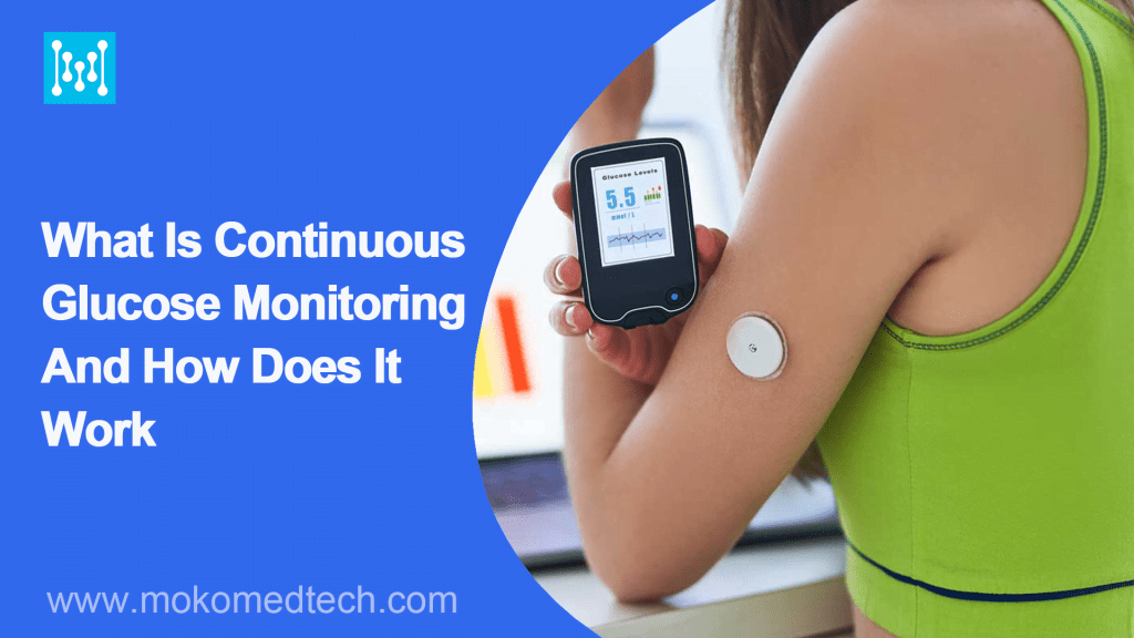 What Is Continuous Glucose Monitoring And How Does It Work