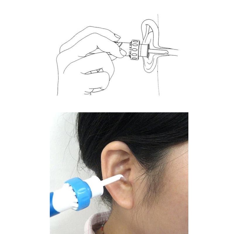 Best Electric Ear Cleaner Ear Wax Vacuum Molooco Shop