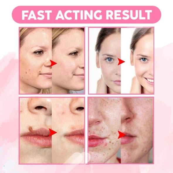 ORGANIC SKIN SPOT PURIFYING SERUM Low Prices Molooco Shop