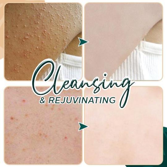 Beauty Volcanic Mud Bath Dew Online Low Prices Molooco Shop