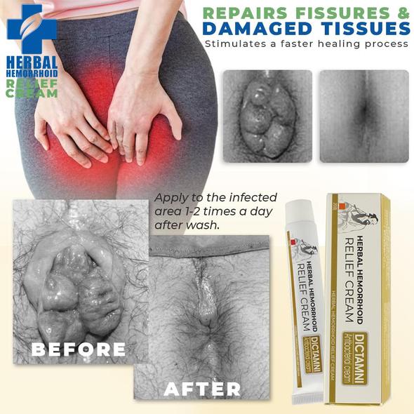 Hemorelief Hemorrhoids Treatment Ointment Low Prices Molooco Shop