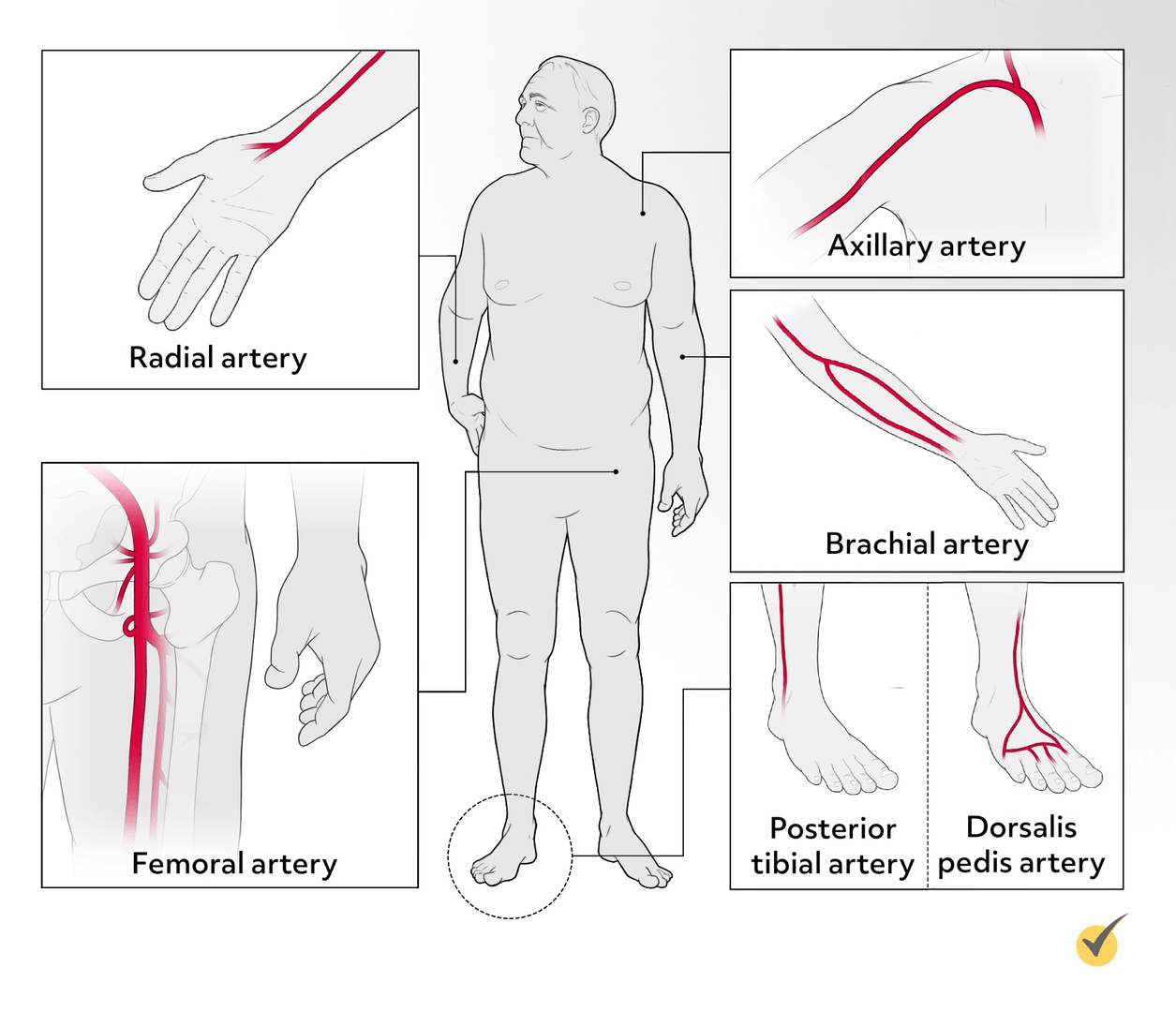 Arterial Punctures (Video)