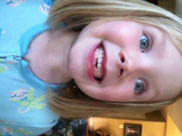 Wiggle your Tooth | MonkeyBar Management