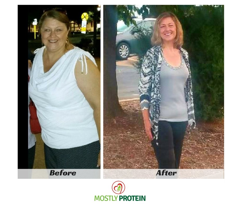 Before and After Bariatric Surgery A Patient's Point of View Mostly Protein