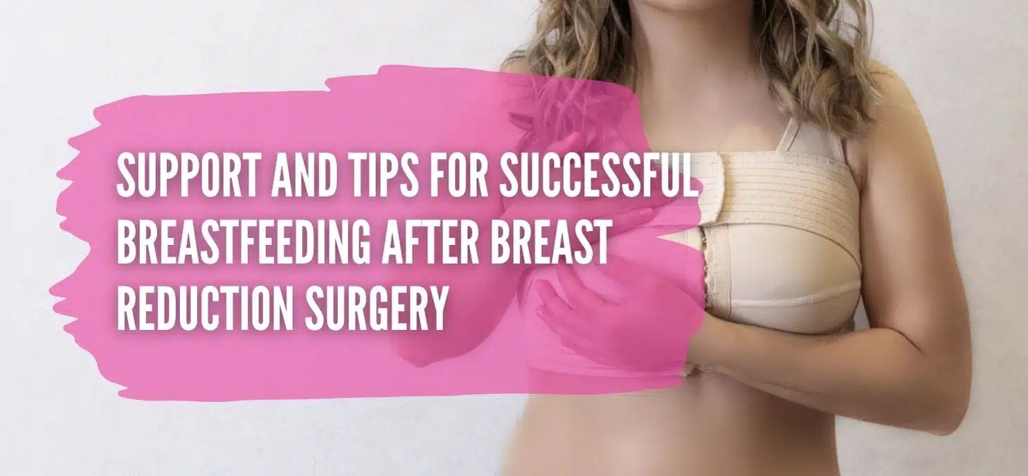 Support And Tips For Successful Breastfeeding After Breast Reduction