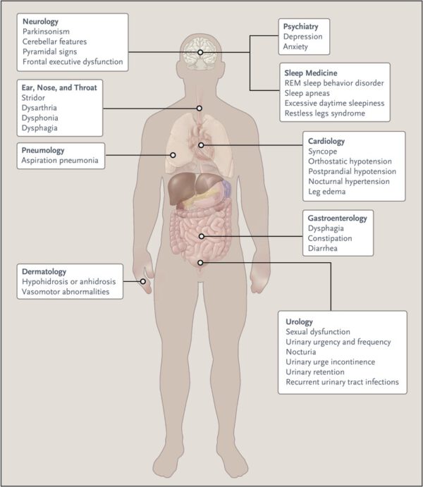 Multiple System Atrophy (MSA) Movement Disorders Clinic
