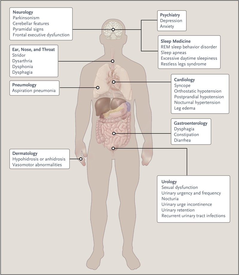 Multiple System Atrophy (MSA) Movement Disorders Clinic