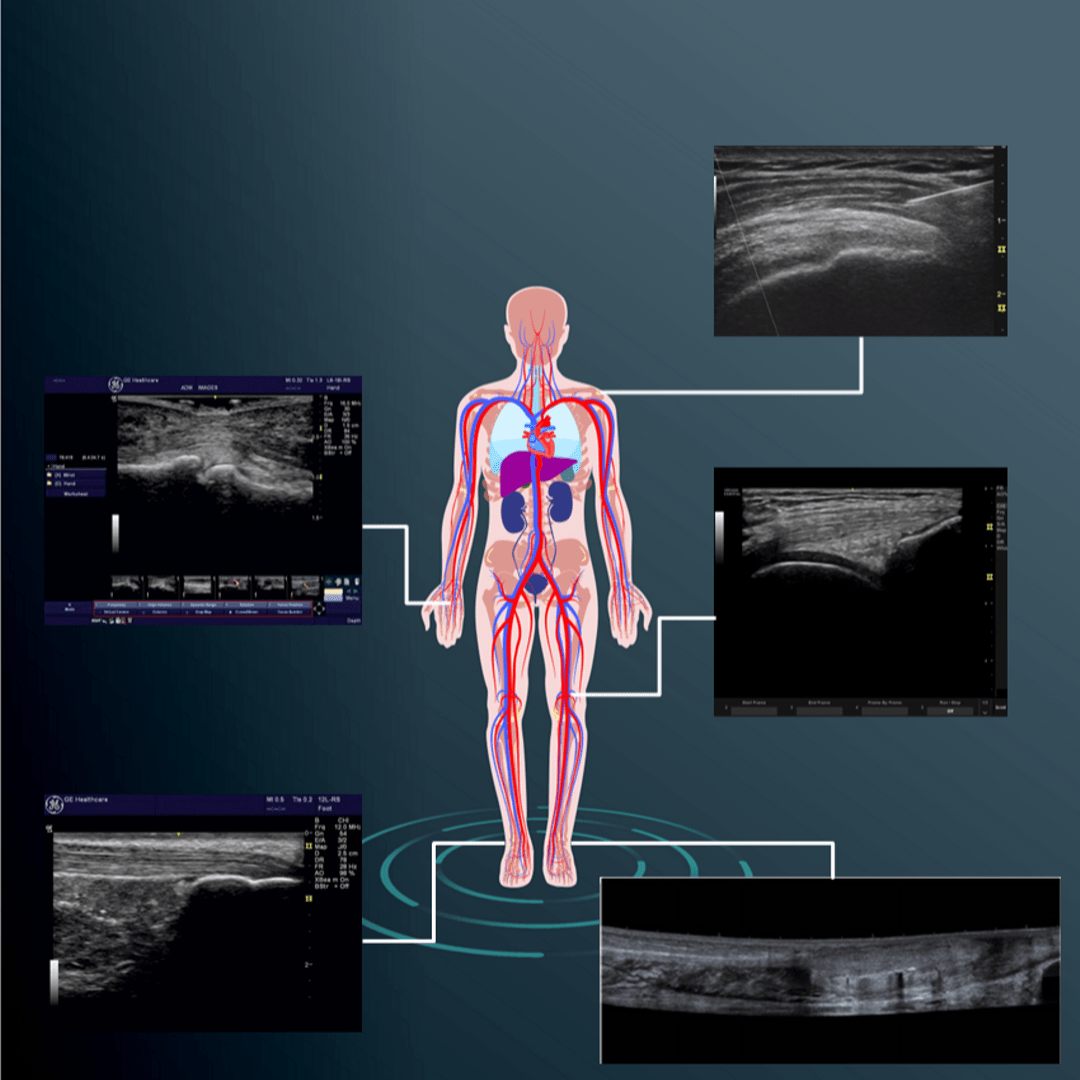 Ecografia dell'Apparato Muscolo Scheletrico Verduci