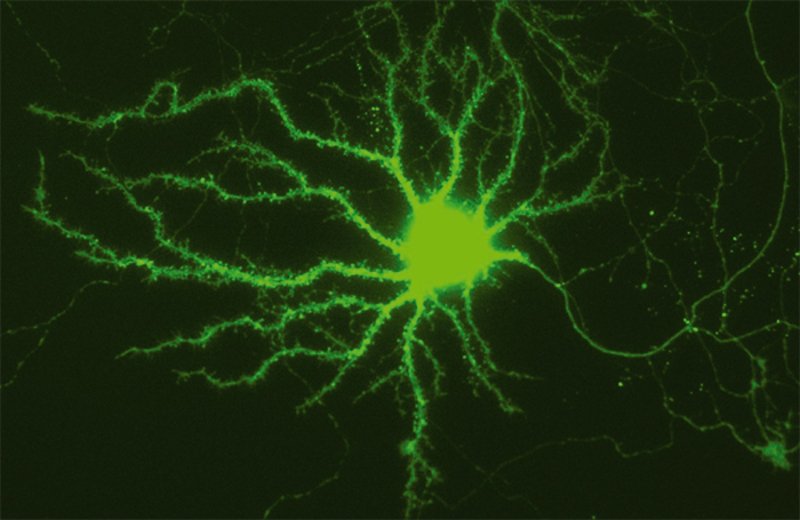 How Nerve Cells Stay in Shape Max Planck Society