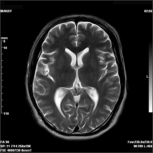 MRI Spectrometers Consoles