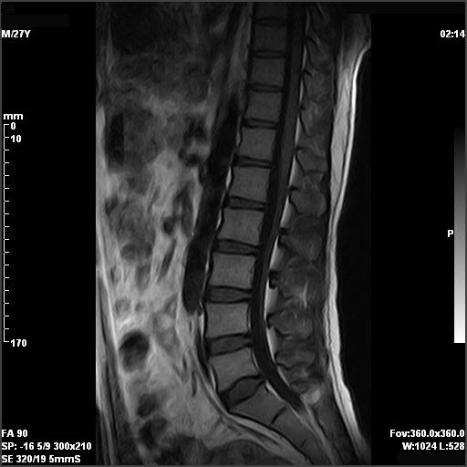 MRI Spectrometers Consoles