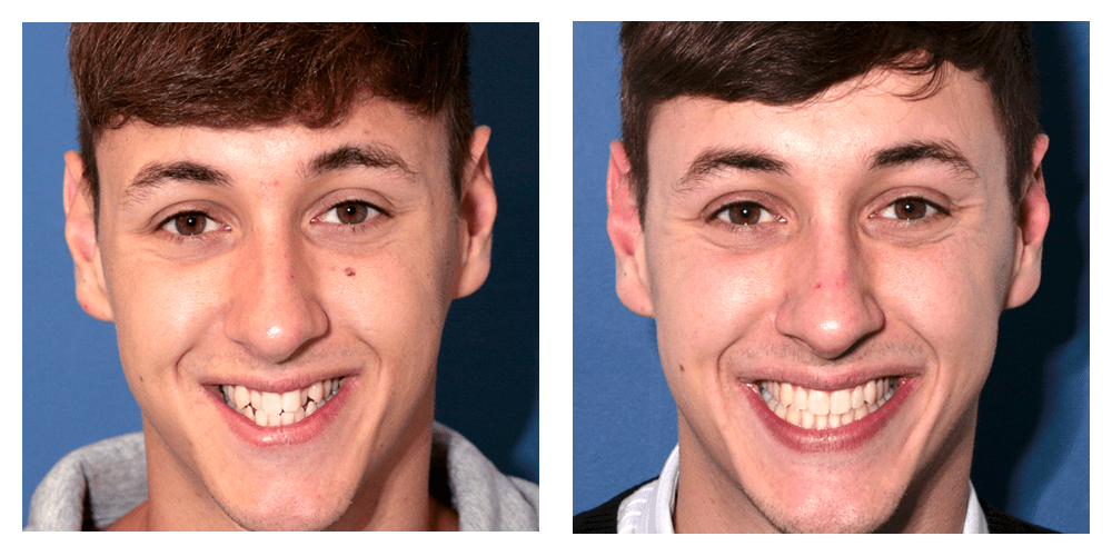 case15 Cosmetic Dentist in Darlington, Durham MSG Dental Practice