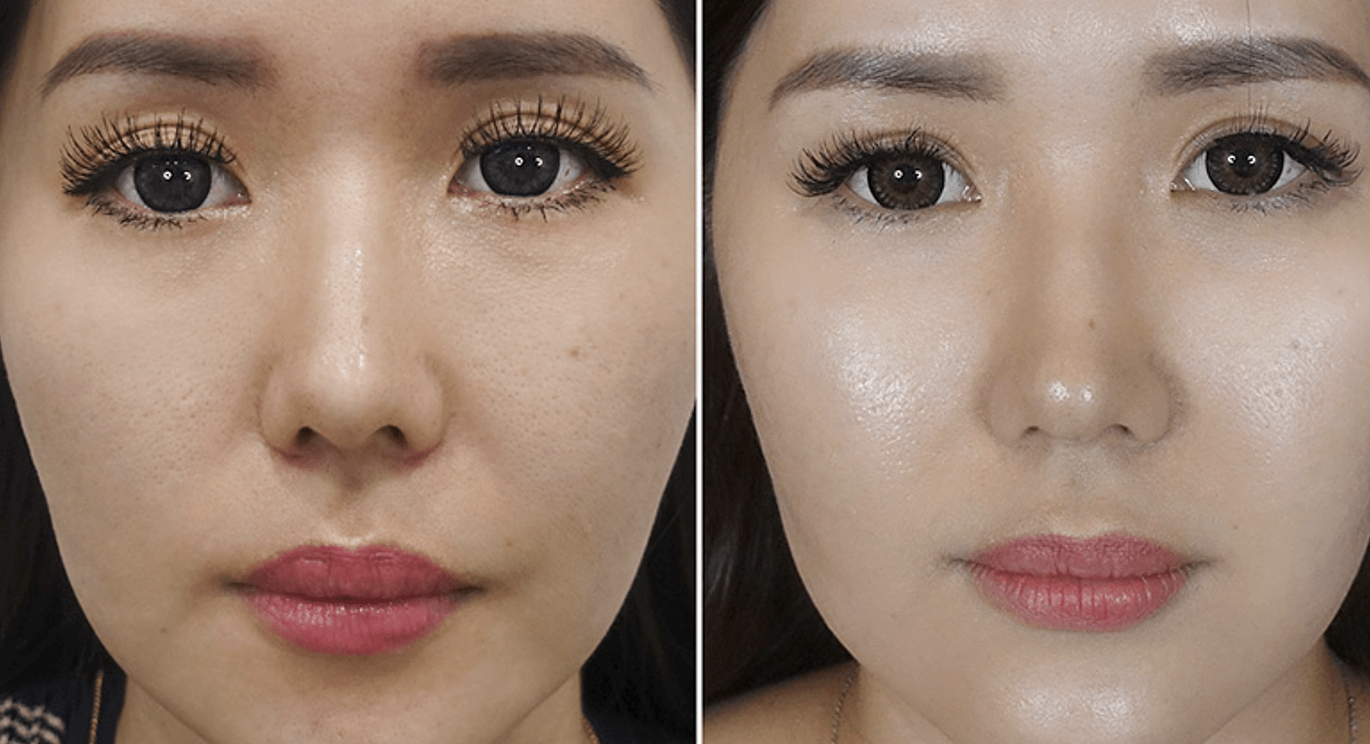 7 Benefits of Incorporating Hyaluronic Acid To Your Skincare MSkin23