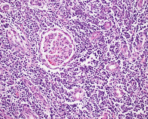 Leptospirosis MSPCAAngell