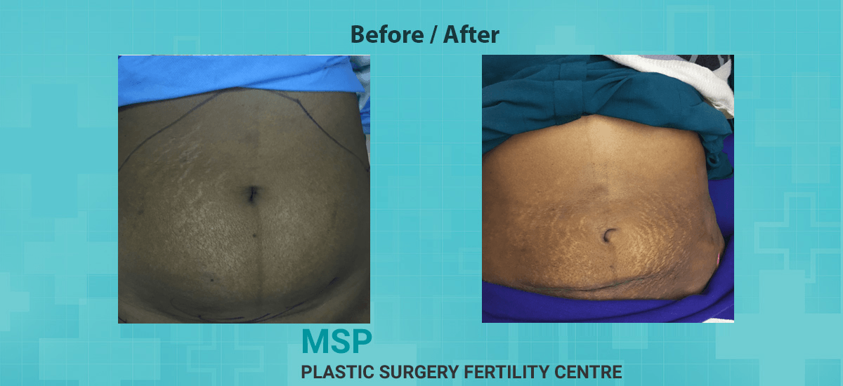 MSP Plastic Surgery Fertility Center
