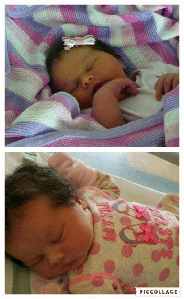 HAIRRAISING the babies born with seriously