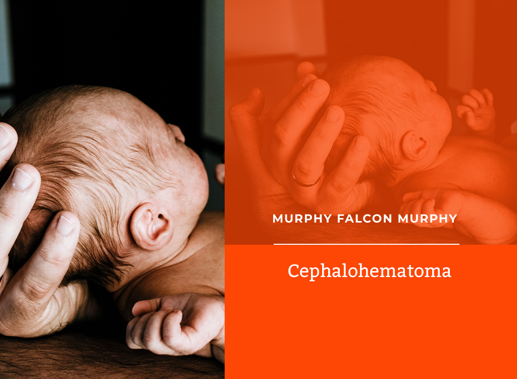 Cephalohematoma Cephalohematoma