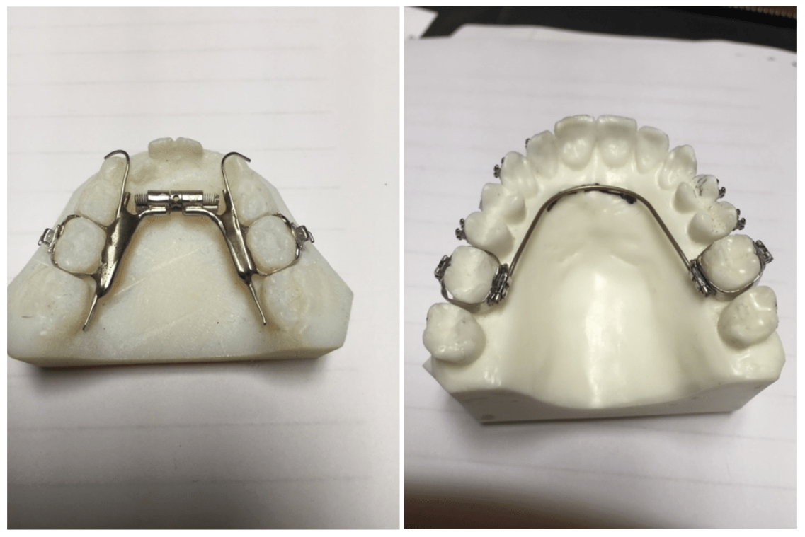 Melanie L. Throne, DDS, PA Orthodontics / Orthotropics in