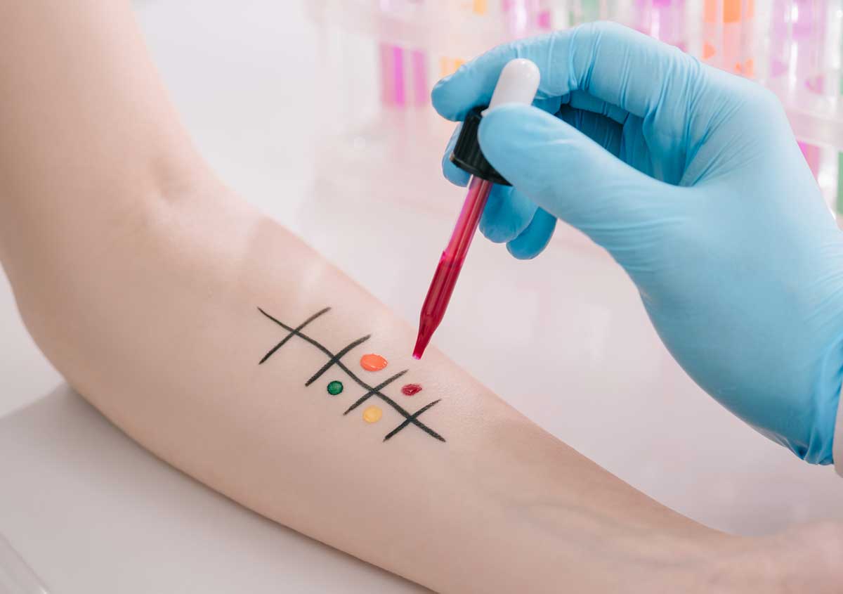Standard Allergy Skin Test IL Standard Allergy Skin Test Crystal Lake