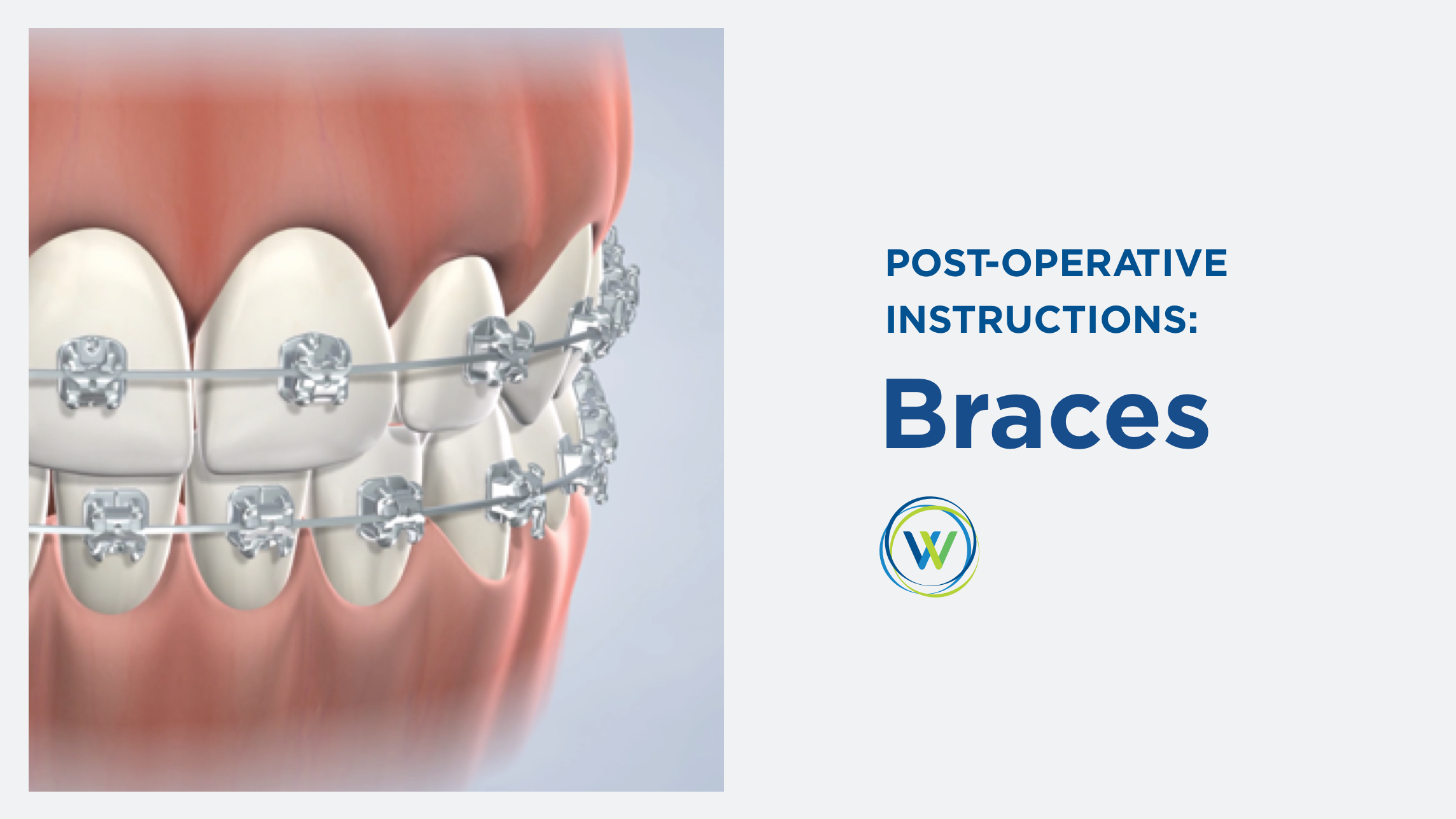 Braces Instructions Winterholler Dental Implants & Cosmetic Dentistry