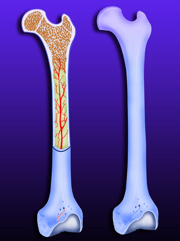 Bone Marrow Disease MyBioSource Learning Center