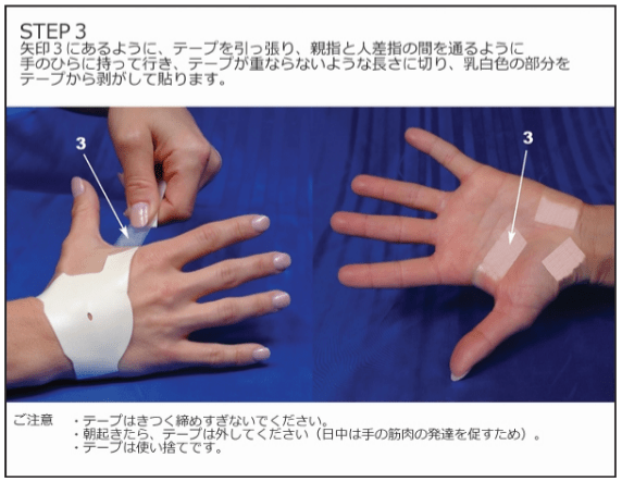 手根管症候群 | 茅ヶ崎の整体【医師の推薦あり】茅ヶ崎あおばスポーツ整骨院はりきゅう院 手根管症候群の治療 | 手根管症候群の症状緩和 | 手根管症候群の治療