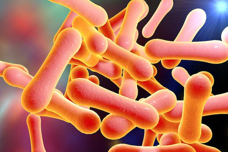 Diphtheria