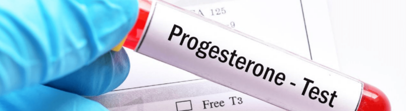 Day 21 progesterone test - what does your level mean? | Fertility Focus