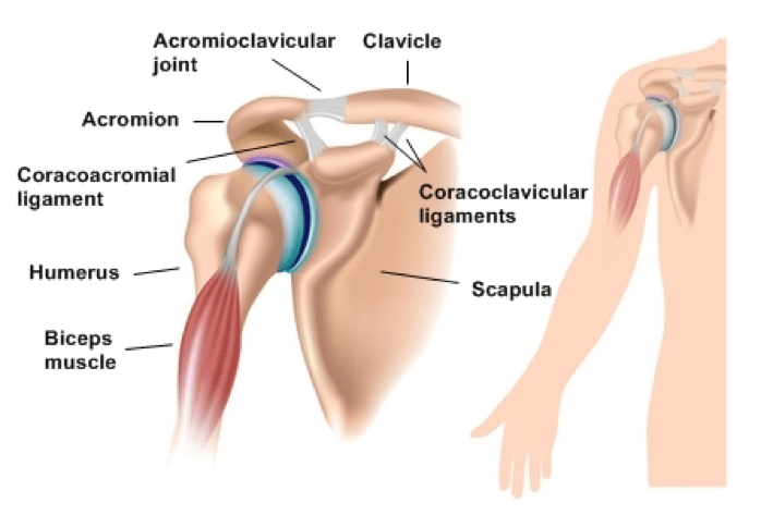 Shoulder Pain from the AC Joint Physio Gold Coast Sports
