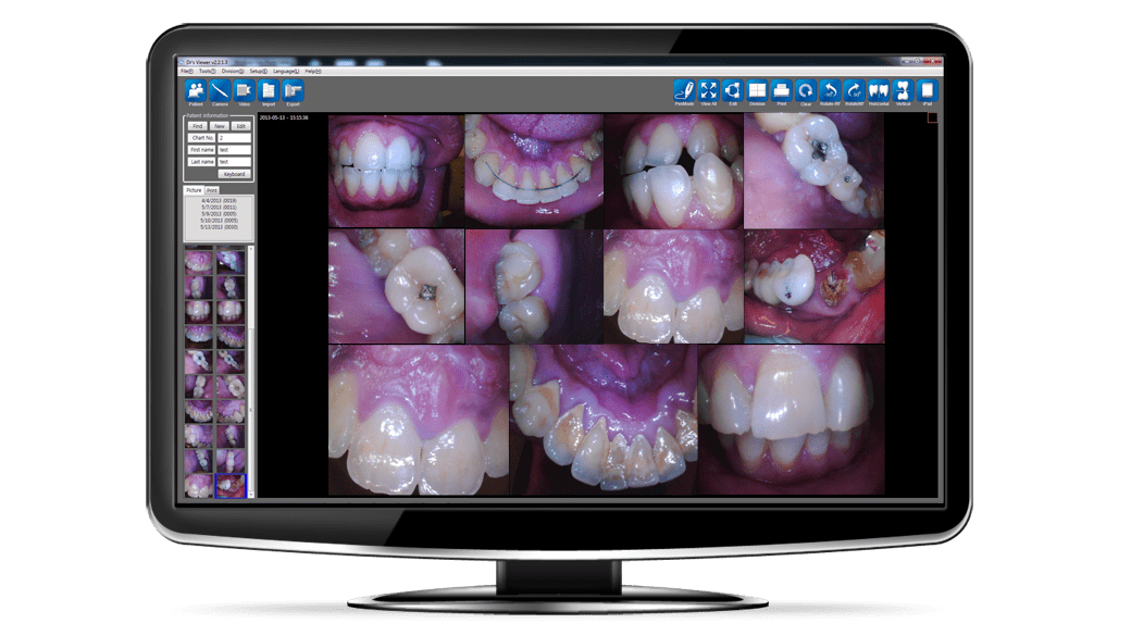 Sample Intraoral Images