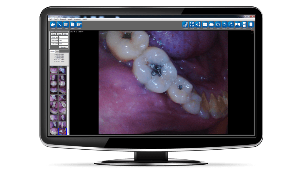 Sample Intraoral Images
