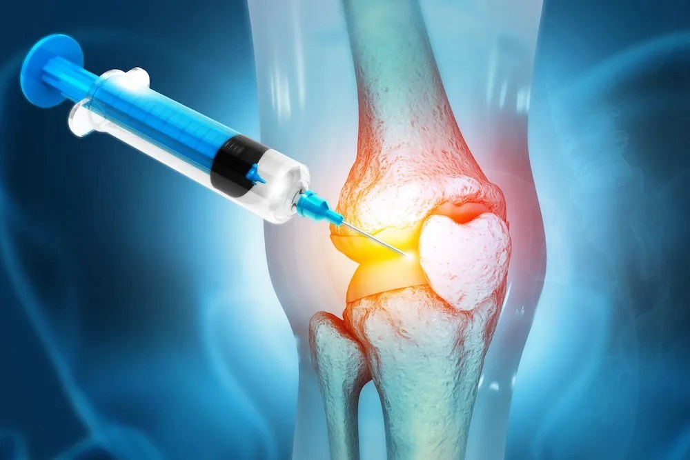 Joint Replacement and Arthritis NonSurgical Options Tidewater